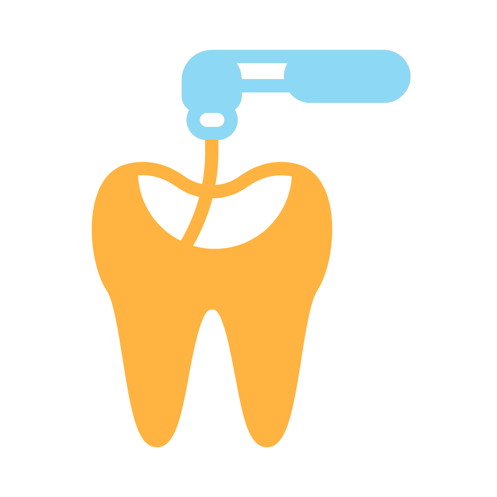 Endodontic Instruments